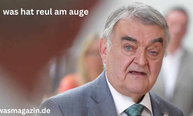 was hat reul am auge
